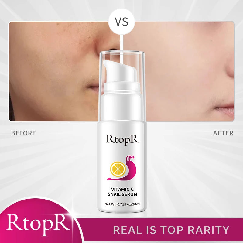 Hyaluronic Vitamin C Snail Serum Anti-Aging Remove Wrinkles Whitening Moisturizing 20ml