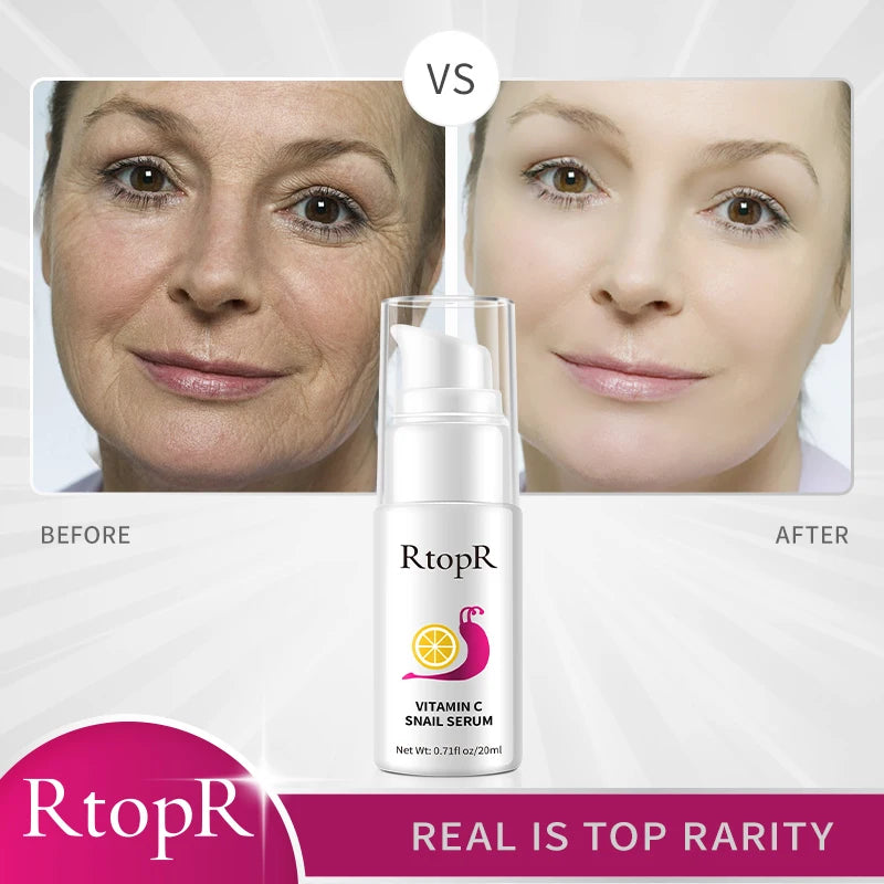 Hyaluronic Vitamin C Snail Serum Anti-Aging Remove Wrinkles Whitening Moisturizing 20ml