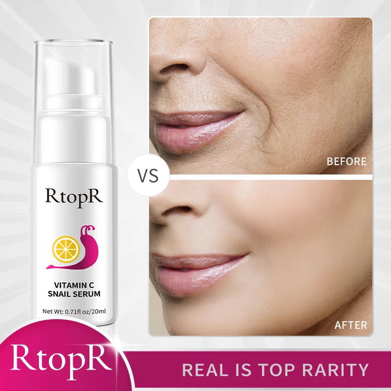 Hyaluronic Vitamin C Snail Serum Anti-Aging Remove Wrinkles Whitening Moisturizing 20ml